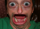 Noooeeesn